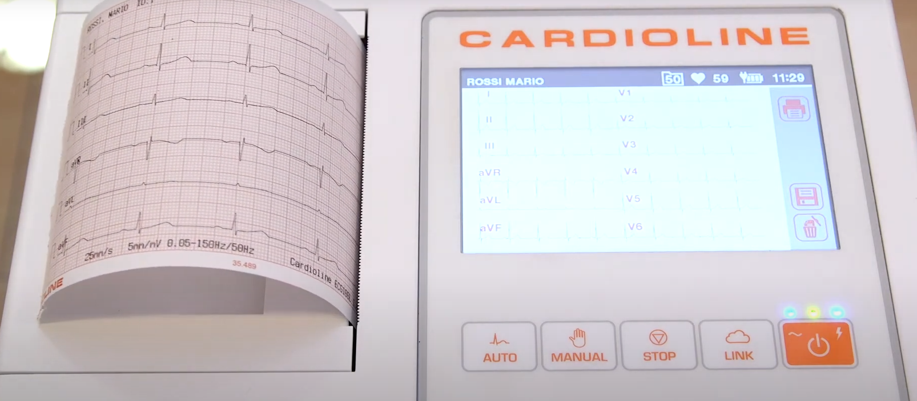 ECG CARDIOLINE ECG100L BASIC - Elettrocardiografo a 3-6 canali