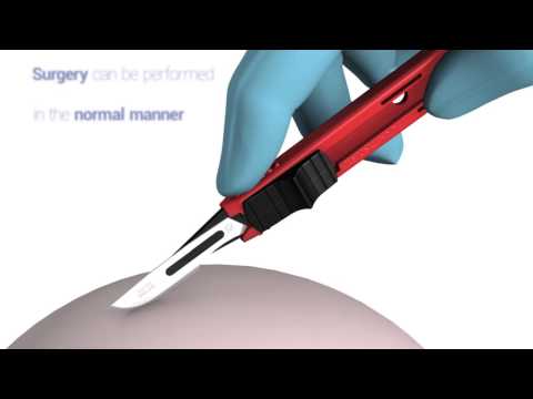 Bisturi di sicurezza monouso sterile Swann-Morton - lama leva punti (conf. 25 pz.)