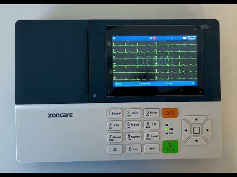 ECG Zoncare iMAC 300pro - Elettrocardiografo a 3 canali Interpretativo Glasgow