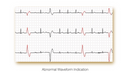 ECG Edan PADECG - Elettrocardiografo a 12 canali - Interpretativo (Acquisitore + Software)