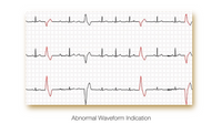 ECG Edan PADECG - Elettrocardiografo a 12 canali - Interpretativo (Acquisitore + Software)