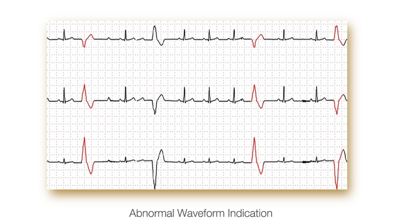 ECG Edan PADECG - Elettrocardiografo a 12 canali - Interpretativo (Acquisitore + Software)