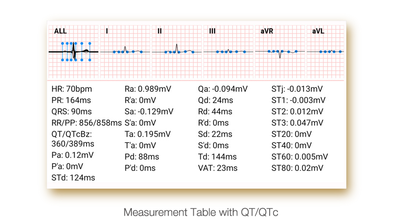 ECG Edan PADECG - Elettrocardiografo a 12 canali - Interpretativo (Acquisitore + Software)