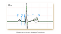 ECG Edan PADECG - Elettrocardiografo a 12 canali - Interpretativo (Acquisitore + Software)