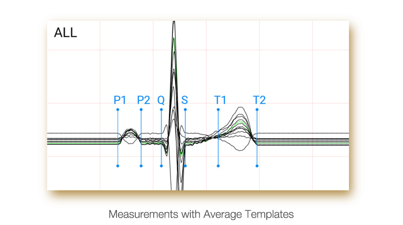 ECG Edan PADECG - Elettrocardiografo a 12 canali - Interpretativo (Acquisitore + Software)