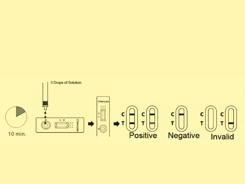 Test clamidia professionale (conf. da 20 test.)