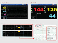 Monitor fetale FC1400 - Singolo
