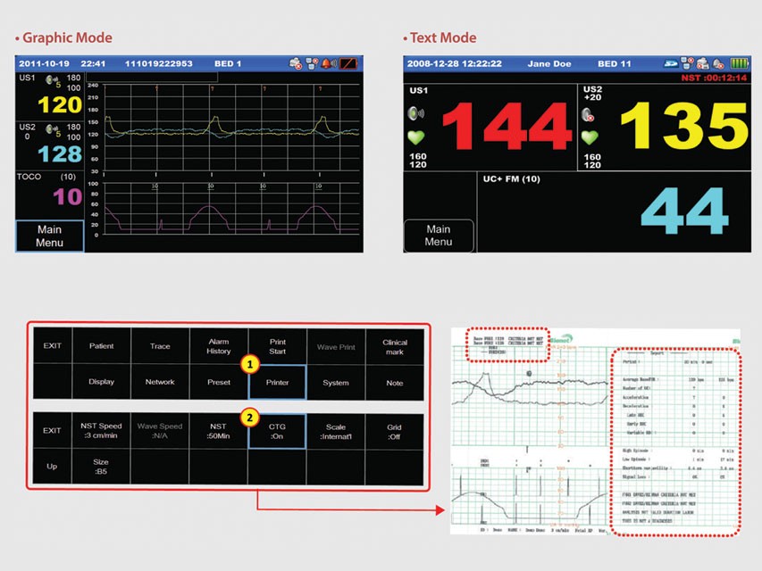 Monitor fetale FC1400 - Singolo