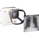 Camera a raggi X portatile REMEX KA6 con collimatore