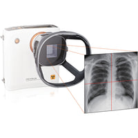 Camera a raggi X portatile REMEX KA6 con collimatore