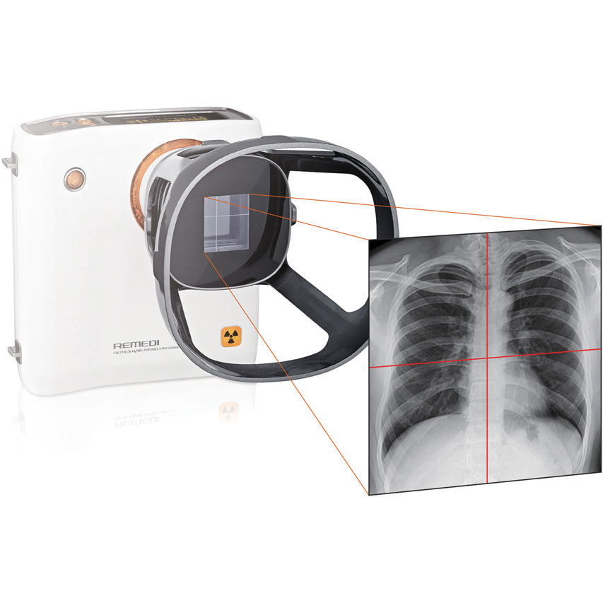 Camera a raggi X portatile REMEX KA6 con collimatore