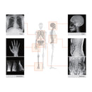 Camera a raggi X portatile REMEX KA6 con collimatore