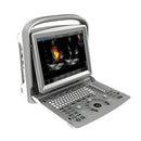 Ecografo Color-Doppler portatile CHISON ECO6 - senza sonde