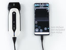 Ecografo Color-Doppler palmare SonoEye P2 con Sonda Lineare 7,5 MHz