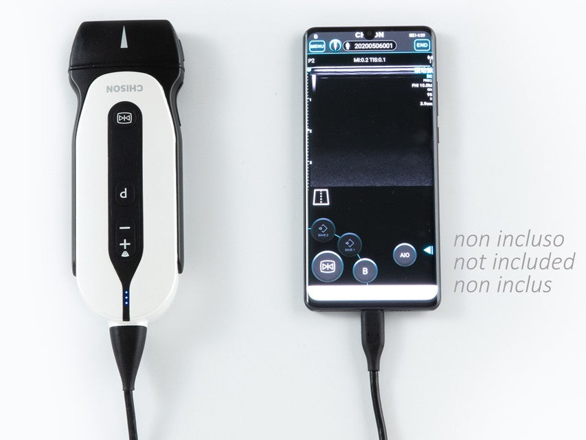 Ecografo Color-Doppler palmare SonoEye P2 con Sonda Lineare 7,5 MHz