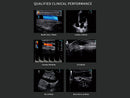 Ecografo Color-Doppler palmare SonoEye P2 con Sonda Lineare 7,5 MHz