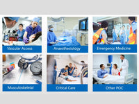 Ecografo Color-Doppler palmare SonoEye P5 con Sonda Convex 3,5 MHz