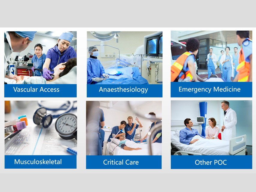 Ecografo Color-Doppler palmare SonoEye P5 con Sonda Convex 3,5 MHz