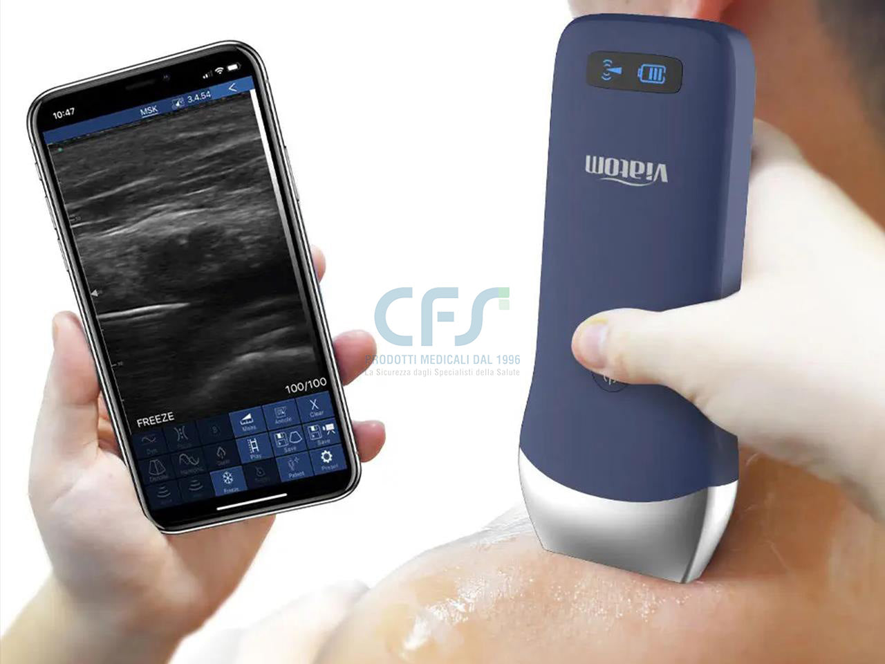 Ecografo Color-Doppler palmare VIATOM con Sonda Lineare