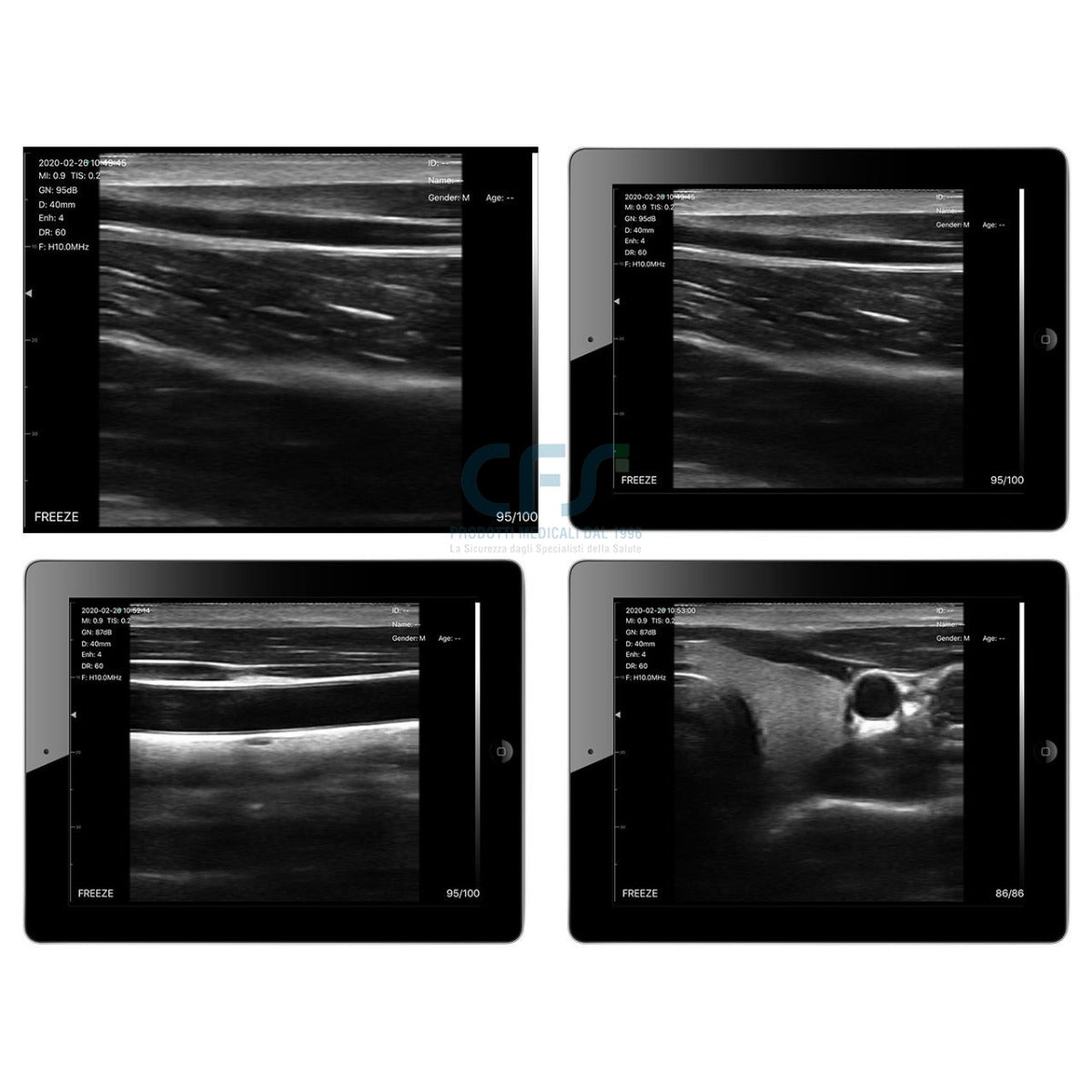Ecografo Color-Doppler palmare VIATOM con Sonda Lineare