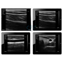 Ecografo Color-Doppler palmare VIATOM con Sonda Lineare