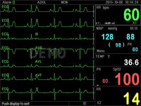 Monitor multiparametrico PC-3000 - SpO2, NIBP, ECG (7 deriv.), RESP e TEMP