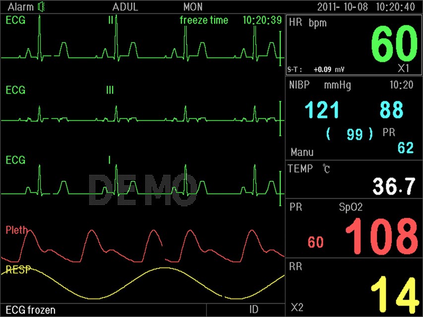 Monitor multiparametrico PC-3000 - SpO2, NIBP, ECG (7 deriv.), RESP e TEMP