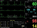 Monitor multiparametrico PC-3000 - SpO2, NIBP, ECG (7 deriv.), RESP e TEMP