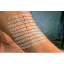 3M Steri-Strip mm 3 x 75 - R1540 (conf. 5 pz.)