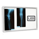 Negativoscopio 70 x 42 a LED con cassonetto