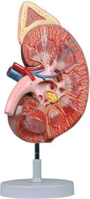 Rene con ghiandola surrenale + corpuscolo renale