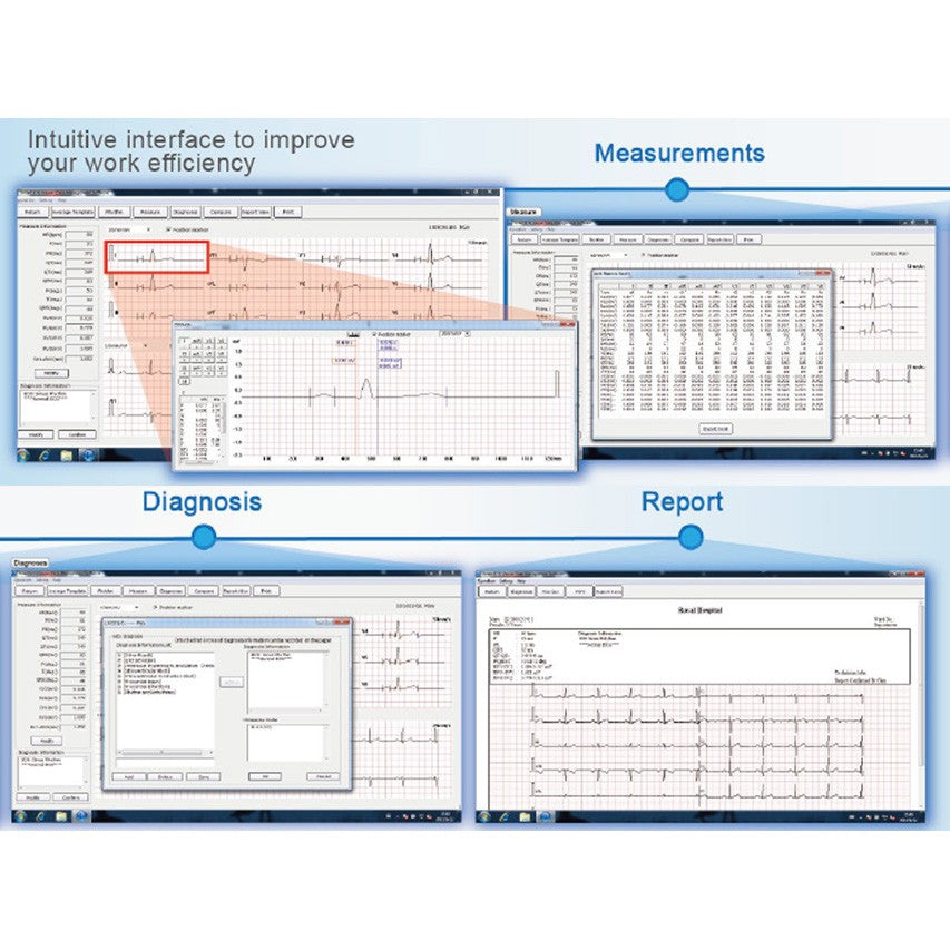 Software PC Smart ECG Viewer per ECG EDAN