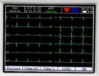 ECG Edan SE-601B - Elettrocardiografo  a 3-6 canali Interpretativo