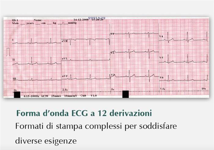 ECG Edan SE-601B - Elettrocardiografo  a 3-6 canali Interpretativo
