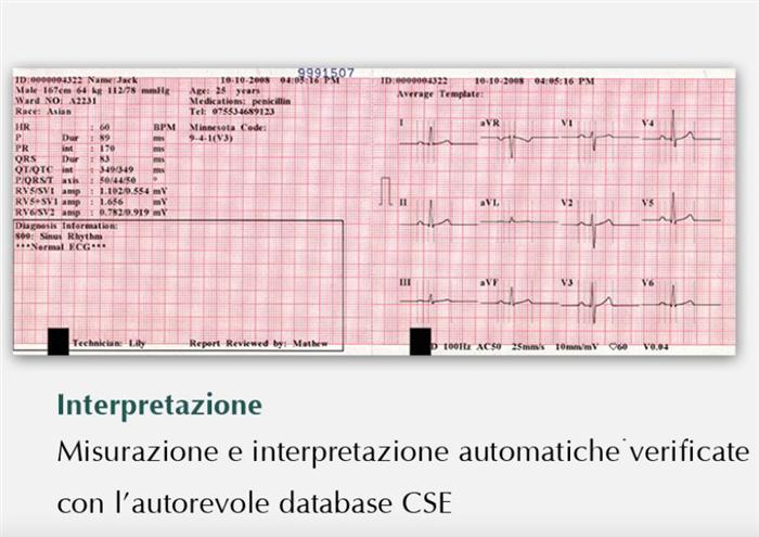 ECG Edan SE-601B - Elettrocardiografo  a 3-6 canali Interpretativo