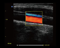 Ecografo Color-Doppler portatile CHISON ECO5 - senza sonde