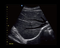 Ecografo Color-Doppler portatile CHISON ECO5 - senza sonde