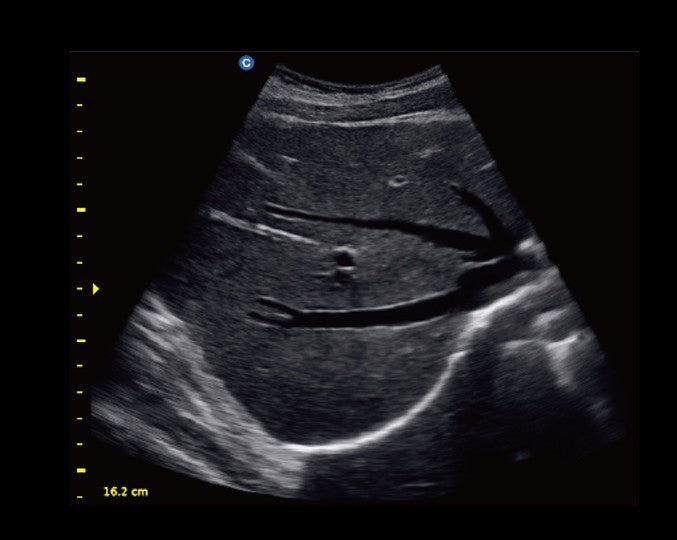 Ecografo Color-Doppler portatile CHISON ECO5 - senza sonde