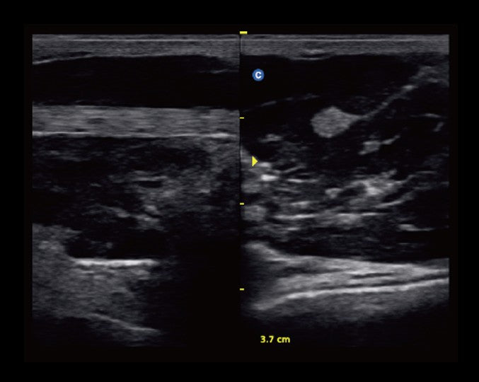 Ecografo Color-Doppler portatile CHISON ECO5 - senza sonde