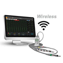 ECG da sforzo Edan SE-1515 - DX12 Wireless + Installazione/Formazione Omaggio
