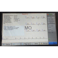 ECG Biocare iE300 - Elettrocardiografo a 3-6 canali Interpretativo