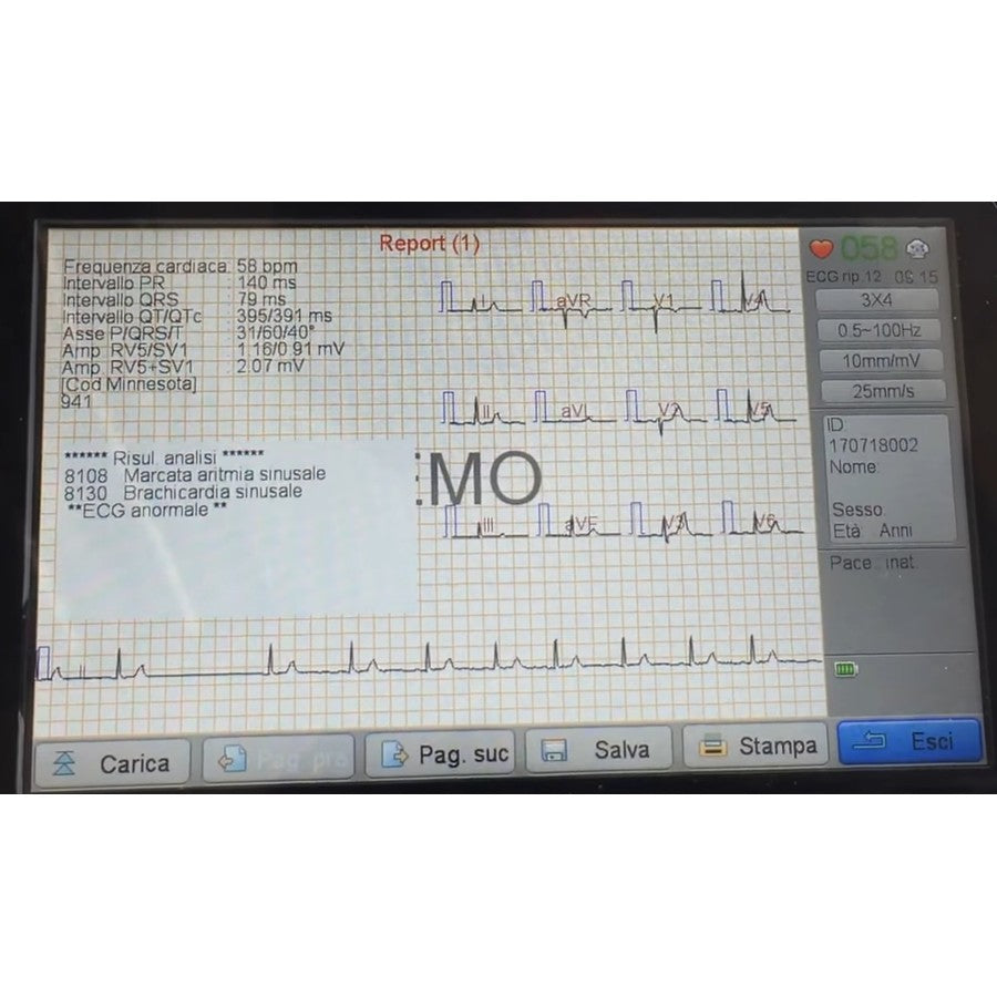 ECG Biocare iE300 - Elettrocardiografo a 3-6 canali Interpretativo