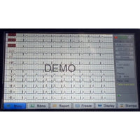 ECG Biocare iE300 - Elettrocardiografo a 3-6 canali Interpretativo