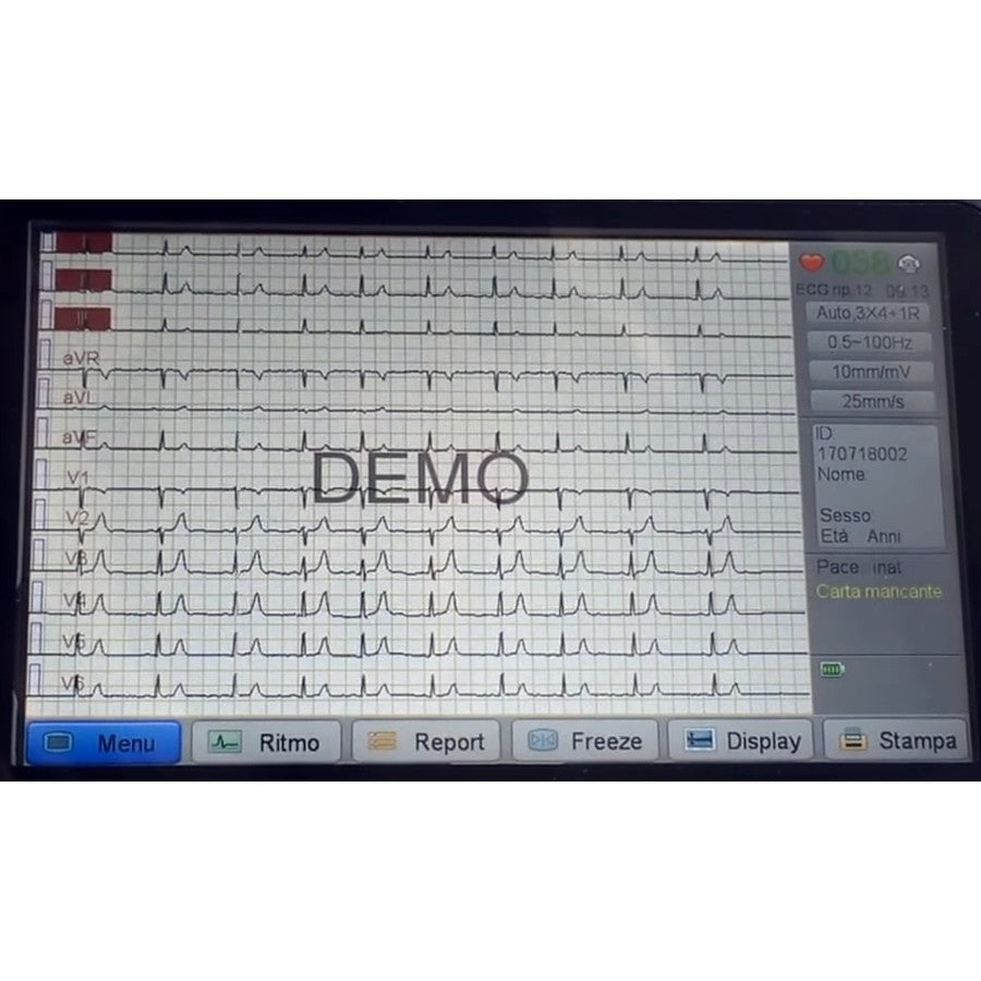 ECG Biocare iE300 - Elettrocardiografo a 3-6 canali Interpretativo