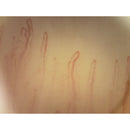 Capillaroscopio Mic-Fi WI-FI