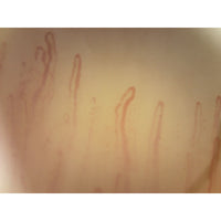 Capillaroscopio Mic-Fi WI-FI