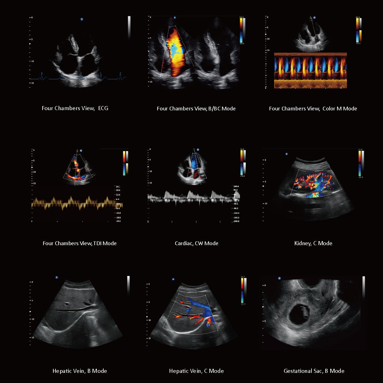 Ecografo Color-Doppler carrellato CHISON QBit5 - senza sonde