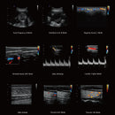 Ecografo Color-Doppler carrellato CHISON QBit5 - senza sonde