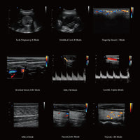 Ecografo Color-Doppler carrellato CHISON QBit5 - senza sonde