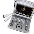 Ecografo Color-Doppler portatile CHISON ECO6 - senza sonde